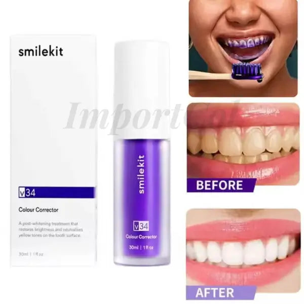 SmileKit™ | Crema Dental Blanqueadora