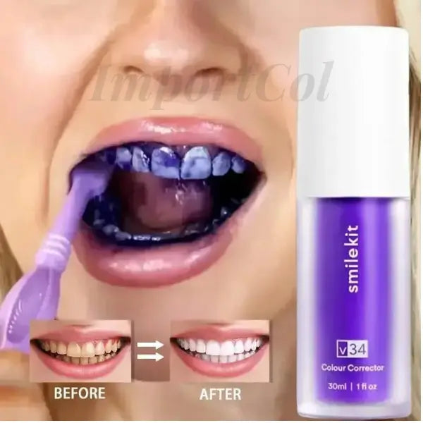 SmileKit™ | Crema Dental Blanqueadora